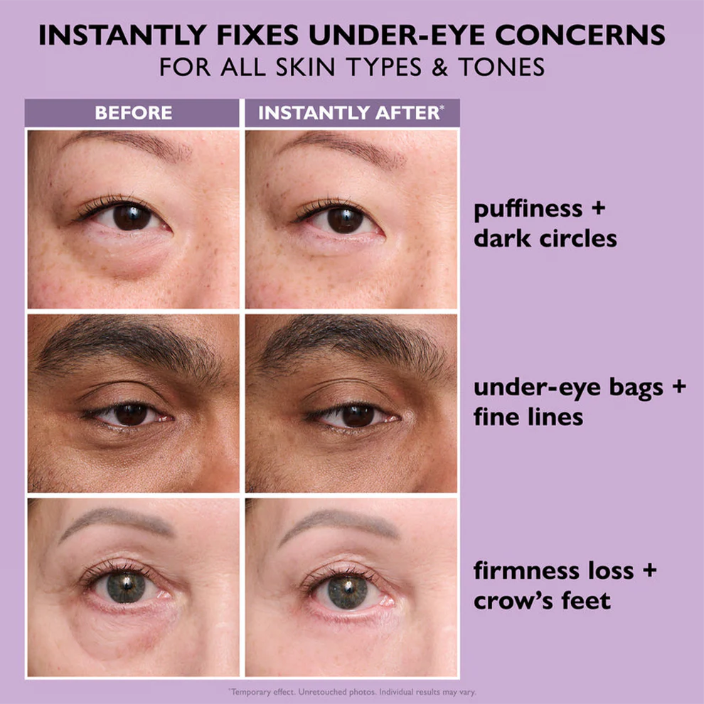 Instant Eye Firming - Eye Tightening Solution
